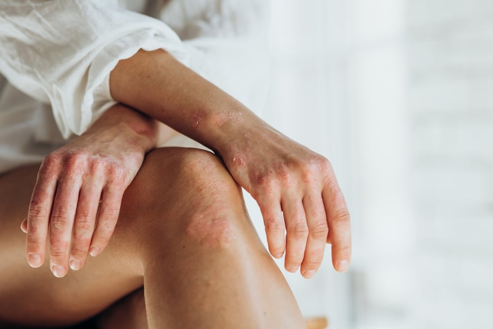 Understanding The Risk Factors For Bursitis Ogden, UT